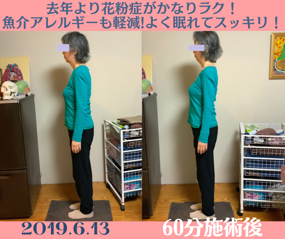 花粉症改善