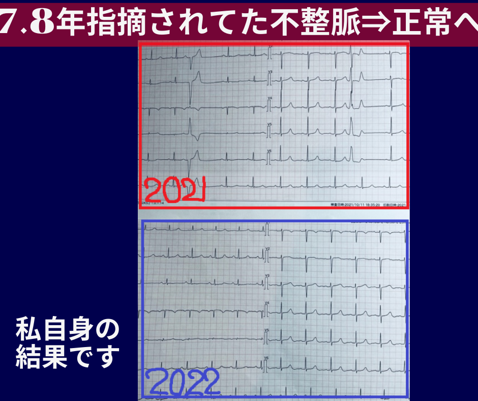 不整脈改善データ
